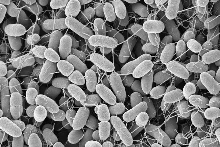 Bakterien Enterobacter cloacae, aufgenommen am Robert Koch-Institut Berlin. Die Keime gehören zu den Darmbakterien.