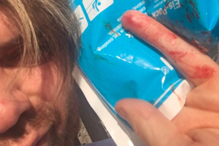 Autsch! Mit einem Cutter verletzte sich der 36-Jährige an seiner Hand.