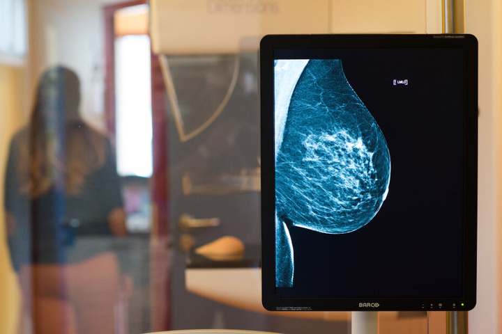 Mammographie-Screenings und ihre Ergebnisse sind nur für die Augen der Patientin und ihres Arztes gedacht. (Symbolbild)
