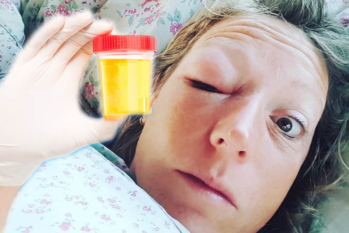 trüber urin frau DrBeckmann