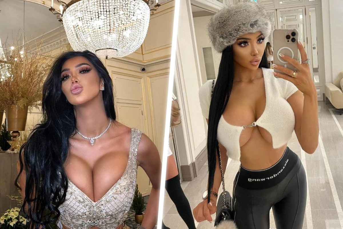 OnlyFans-Superstar Chloe Khan gibt eine Million für Beauty OPs aus