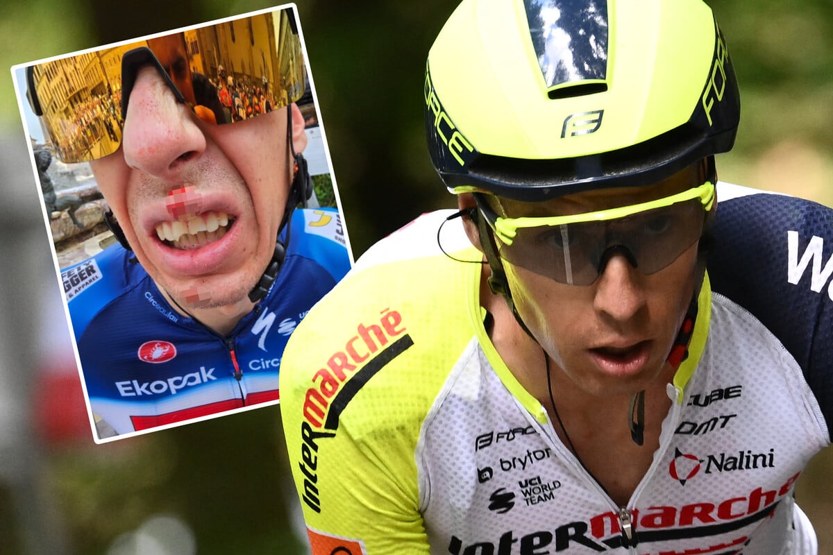 Fieser Sturz direkt vor Tour-Start: Radstar bricht sich drei Zähne ab!