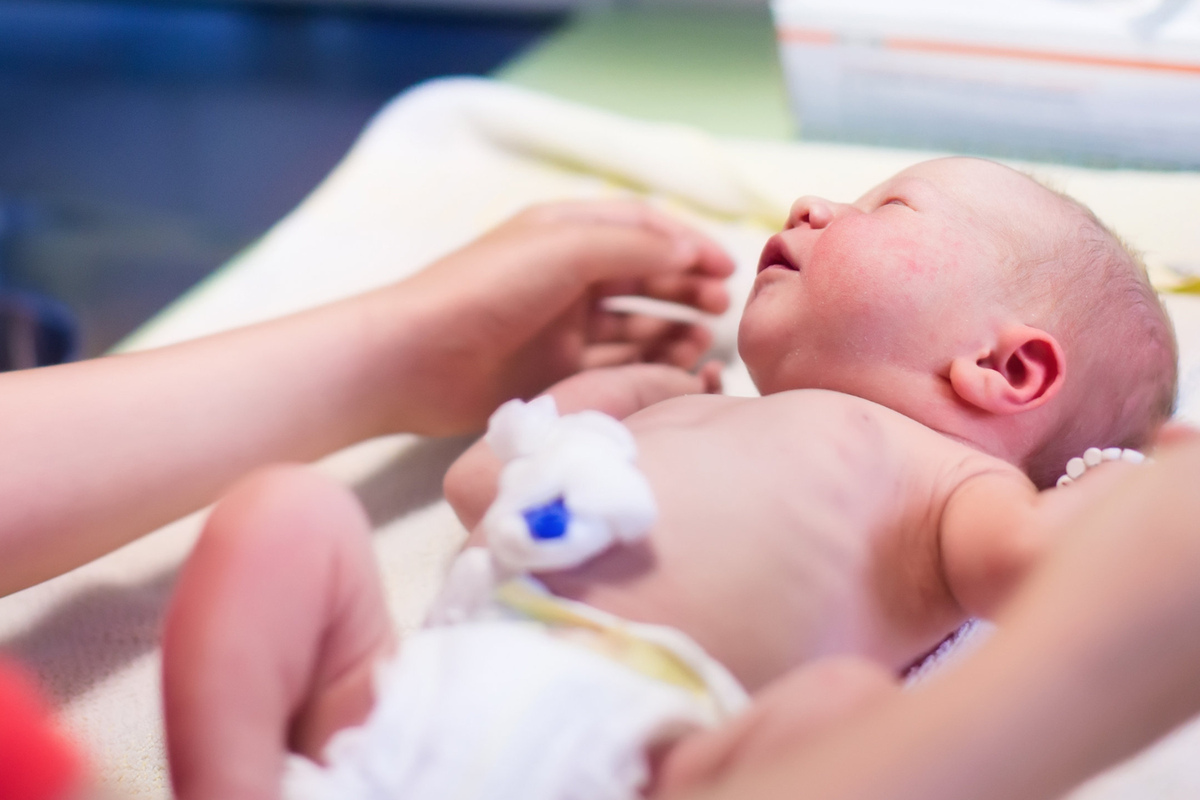 Mediziner staunen: Baby trägt bei Geburt eigenen Zwilling in sich! 