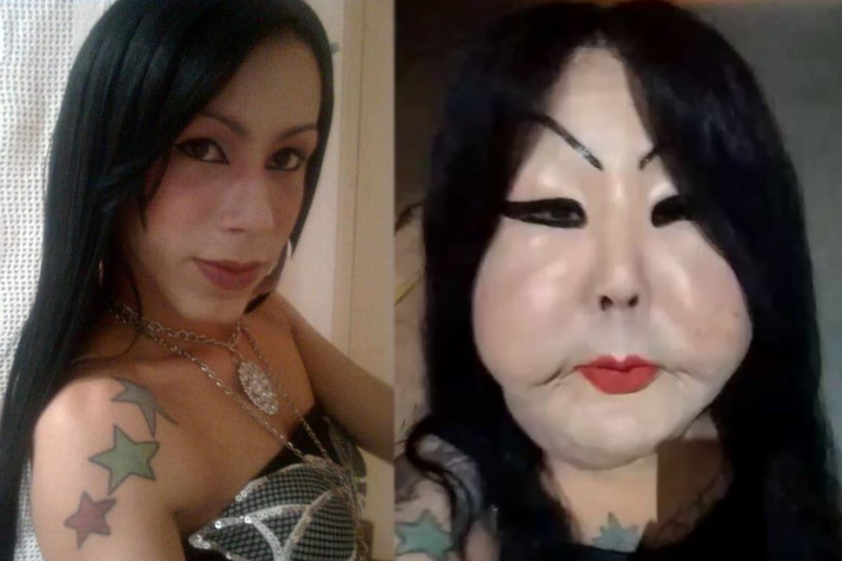 Illegal plastic surgery leaves woman begging for money to
