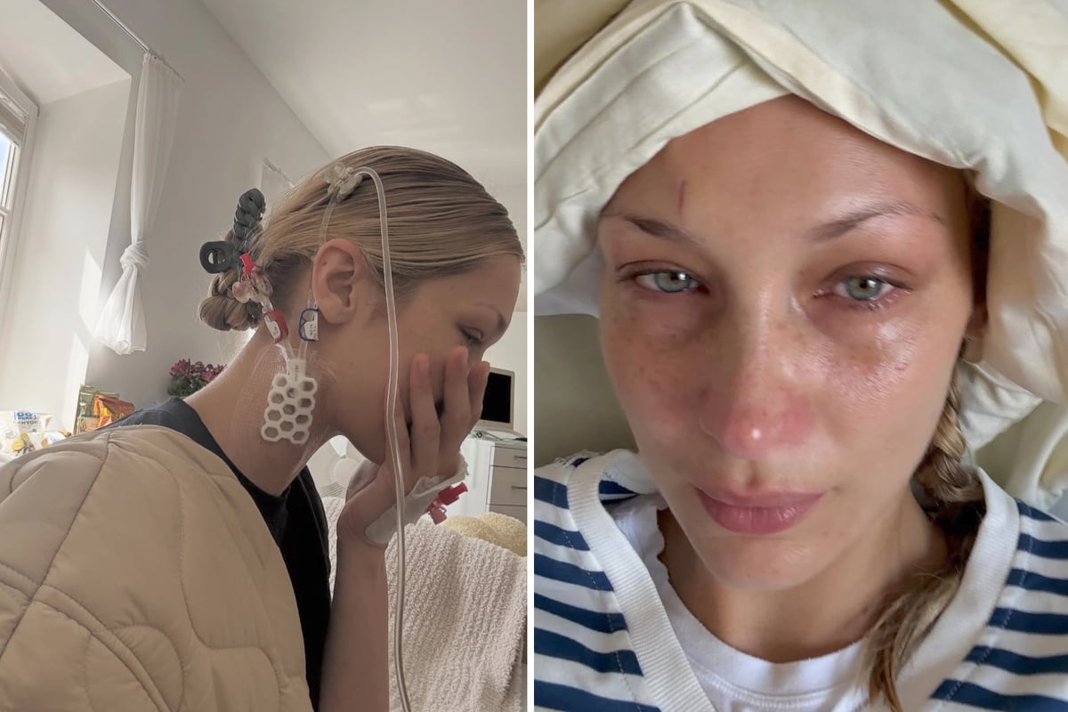 Abgek-mpft-und-verheult-im-Krankenbett-Bella-Hadid-versetzt-Fans-mit-Post-in-Sorge