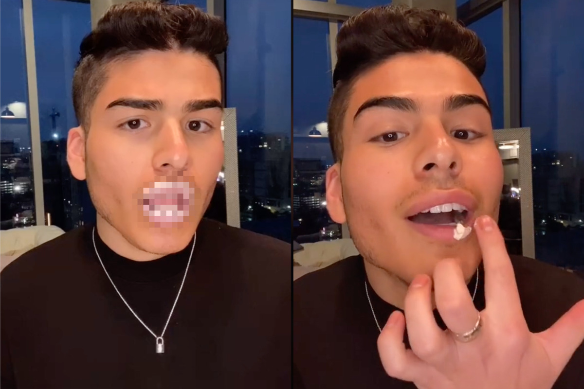 TikToker uses erection cream for fuller lips, the results are disturbing