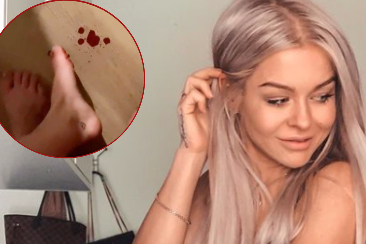 That backfired: “Love Island” -Julia injured herself in an Instagram challenge