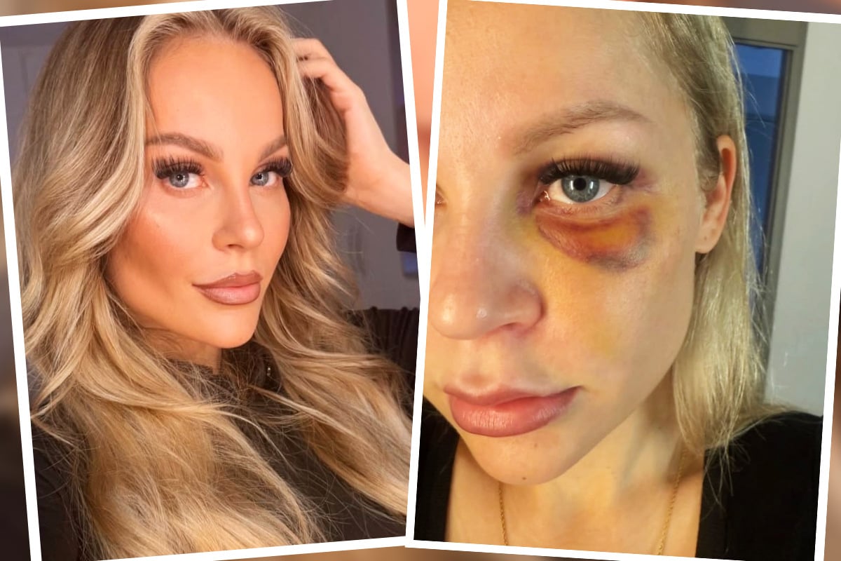 Influencerin macht Gewalt-Erfahrungen öffentlich: 