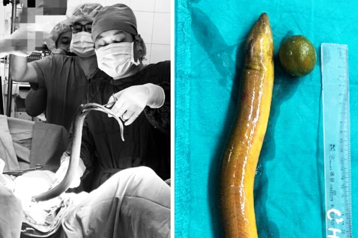 Ekelhaftes Sexperiment: Mann führt sich lebenden Aal ein und stirbt fast