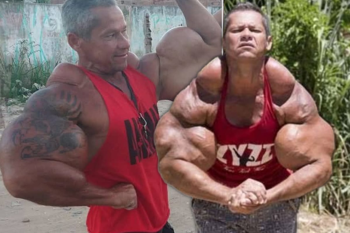 Bodybuilder spritzte sich jahrelang Öl in die Muskeln: Nun ist "Popeye" tot