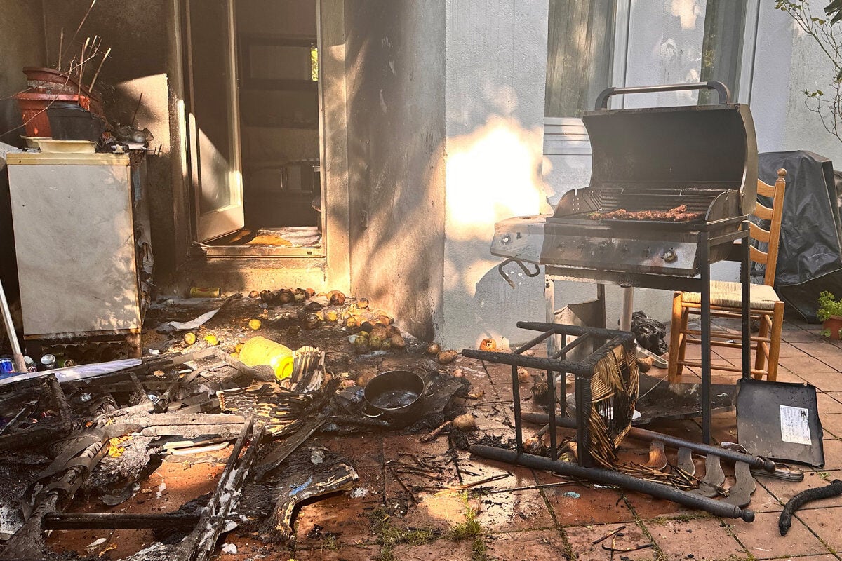 Grill explodiert: Zwei Männer mit schweren Brandverletzungen in Klinik