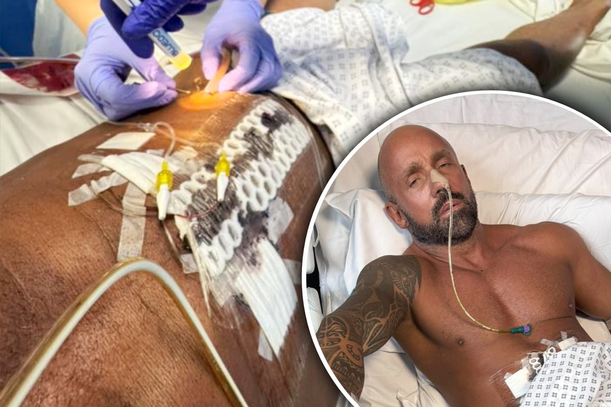 YouTuber isst Ananas und erleidet heftige Schmerzen: Plötzlich schwebt er in Lebensgefahr