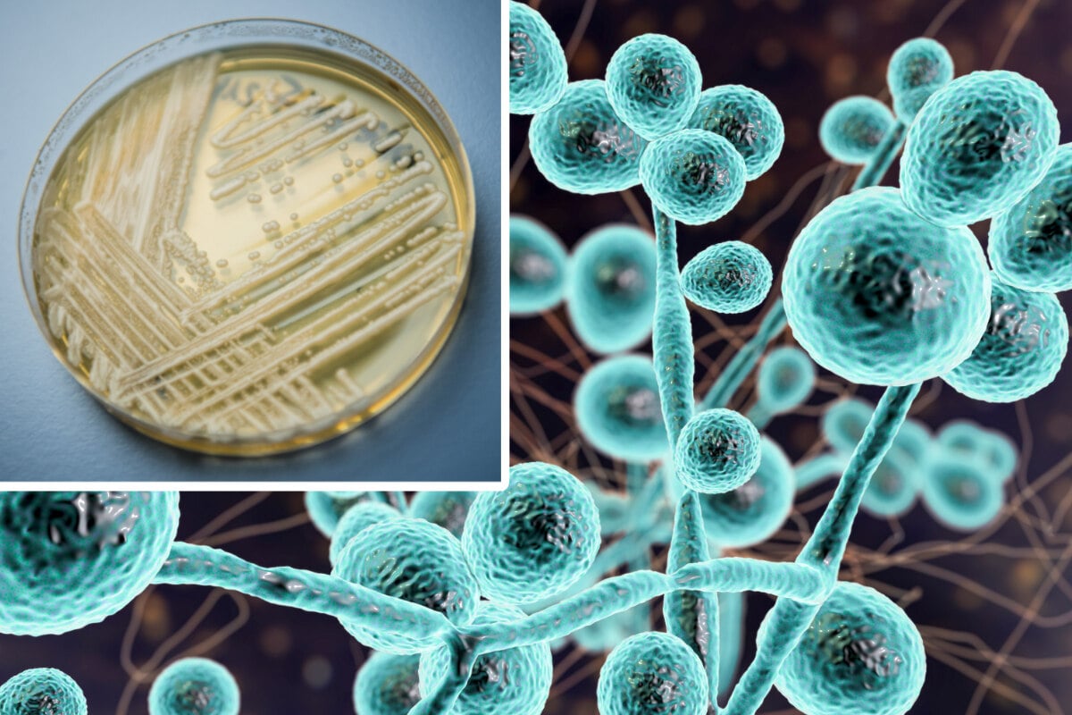How dangerous is the yeast Candida auris? - Time News