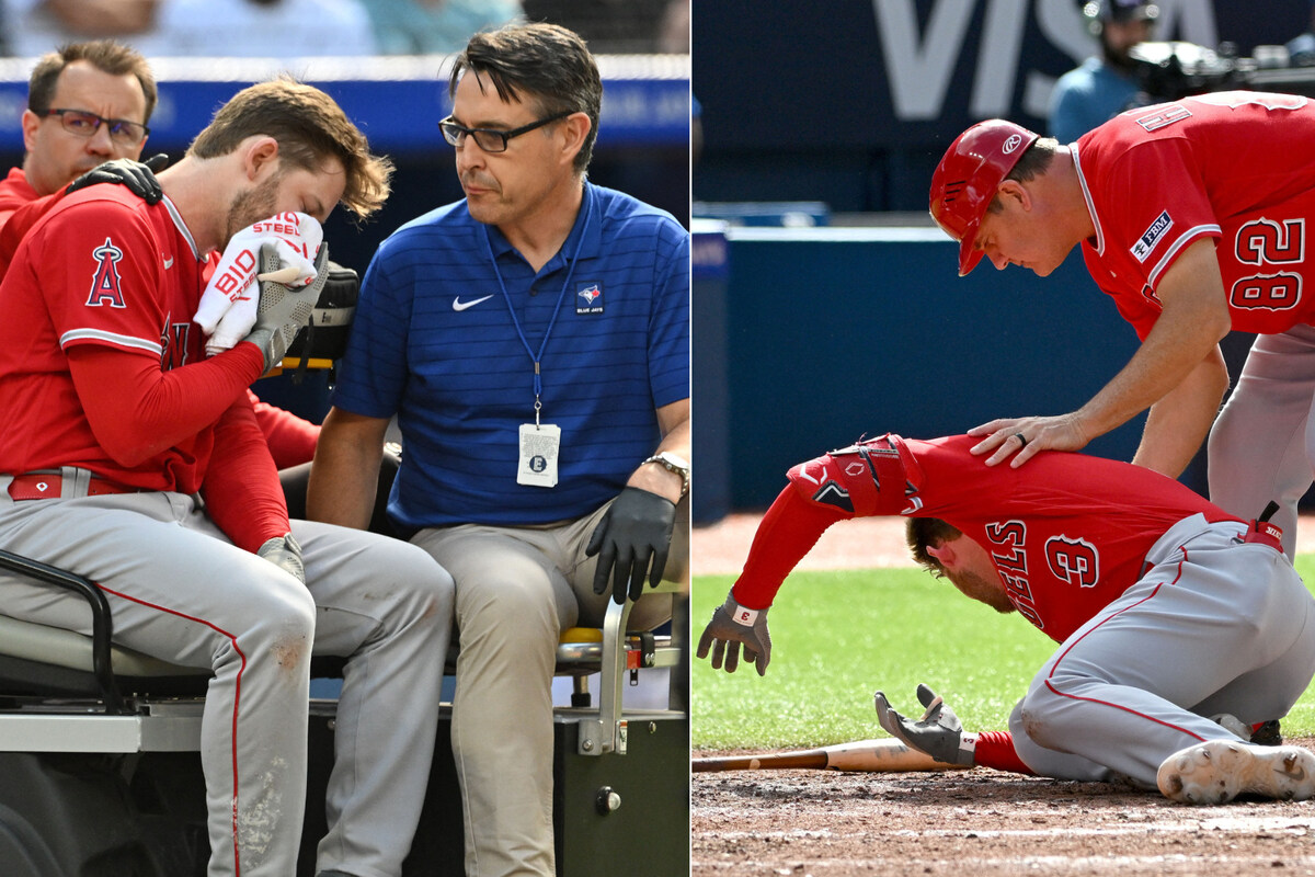 Angels' Taylor Ward bloodied, carted off after taking pitch to face