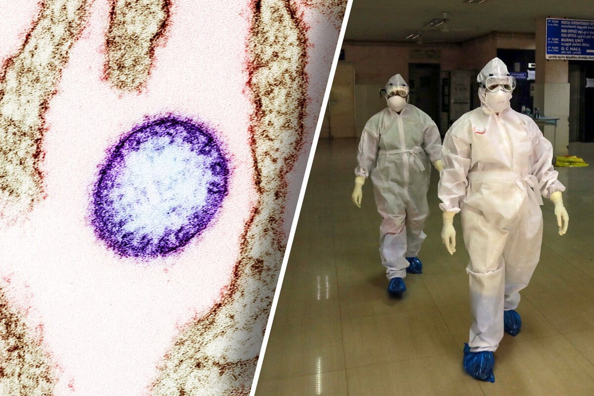 Erster Todesfall: Horror-Erreger Nipah-Virus ausgebrochen