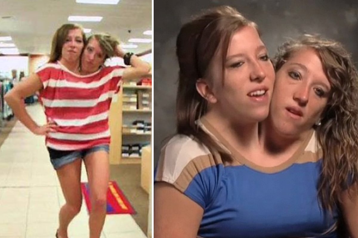 Real or Fake? 👇👇👇 . Abby and Brittany Hensel are conjoined