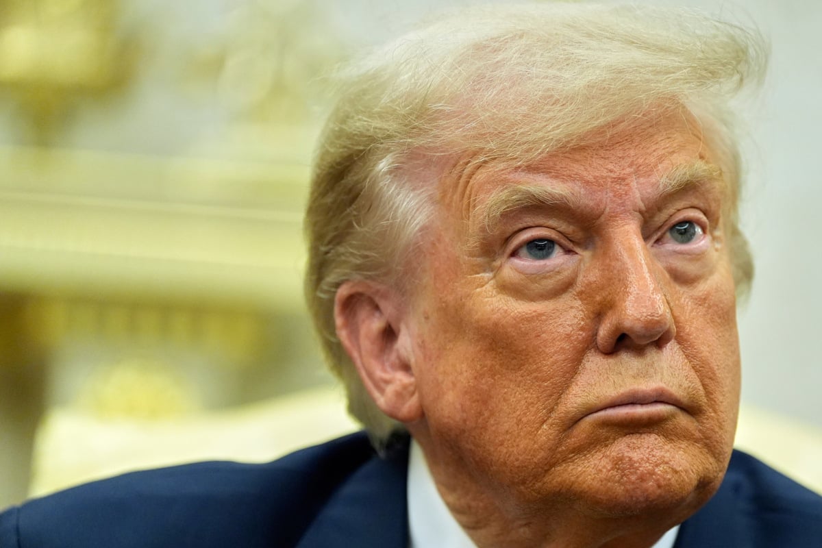 Trump leidet an chronisch venöser Insuffizienz: Regierung versichert beste Gesundheit