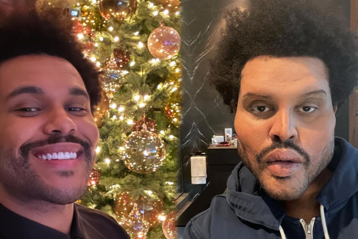 The Weeknd's latest selfie makes fans ask what happened to his face?