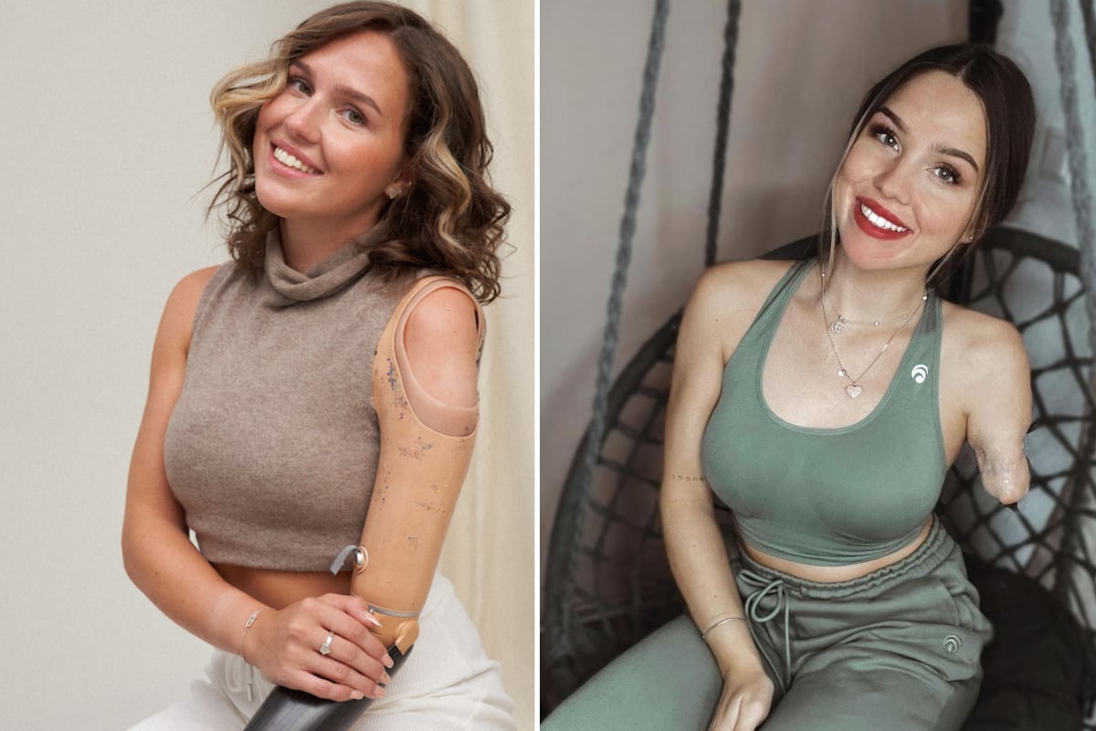 Nach ArmAmputation Gina Rühl will "Miss Germany" werden!