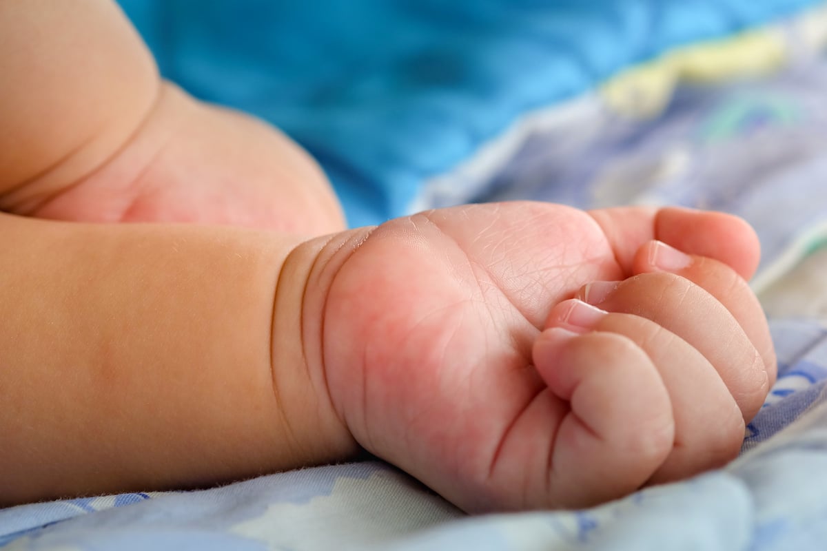 Tragische Geburt: Baby kommt mit vier Armen, vier Beinen und zwei Gesichtern zur Welt