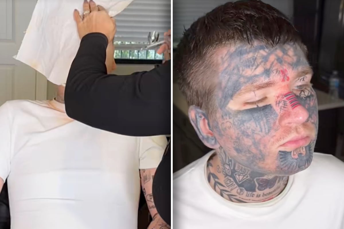 Mann will Gesichts-Tattoos für Hochzeit loswerden: Was er dann tut, beeindruckt so viele