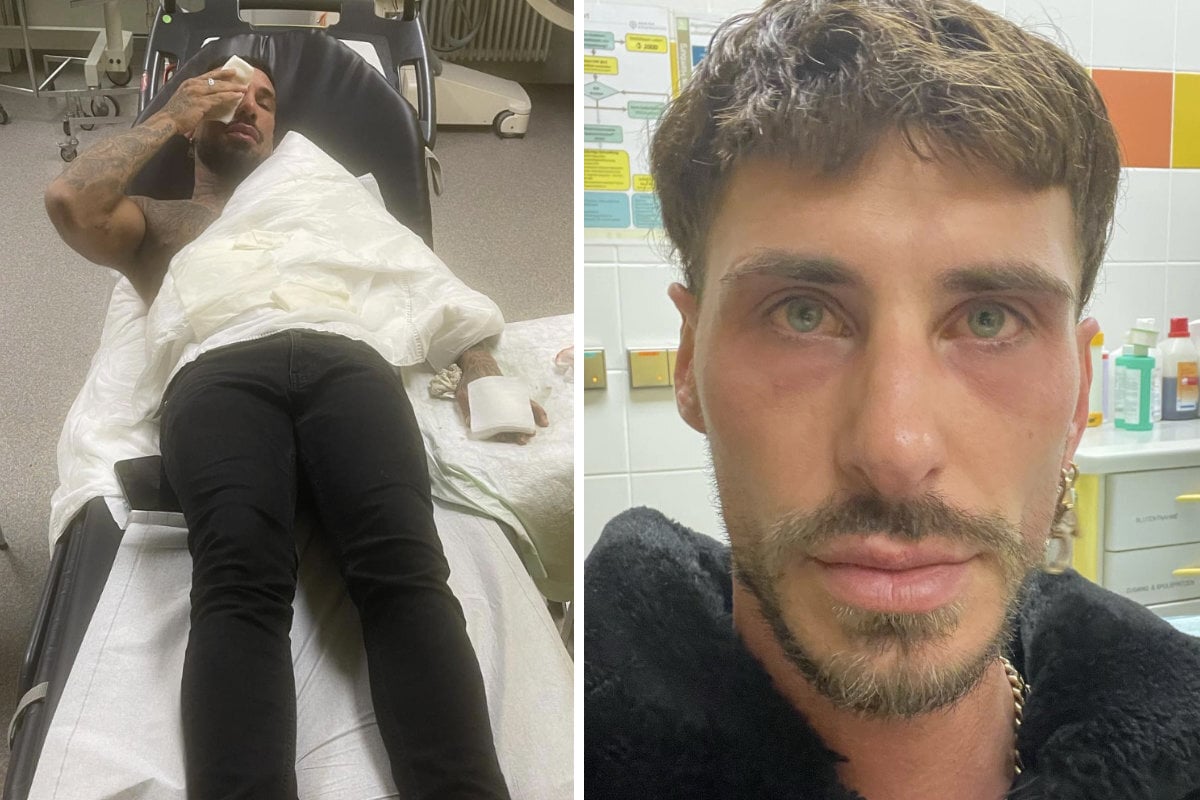 Nachbarn riefen Polizei: "Charming Boys"-Kandidat Pitzi Müller erneut brutal angegriffen