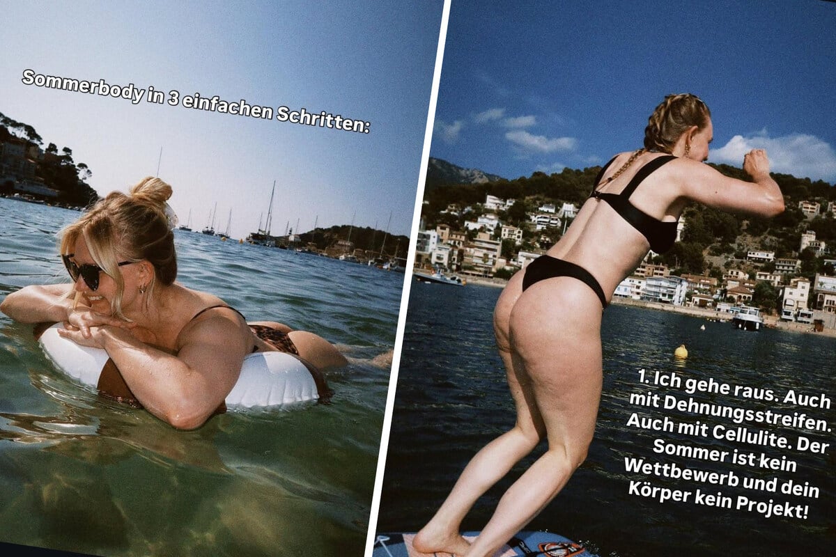 Cellulite-Na-und-Carina-M-ller-Mikkelsen-feiert-den-Sommer-ohne-Komplexe