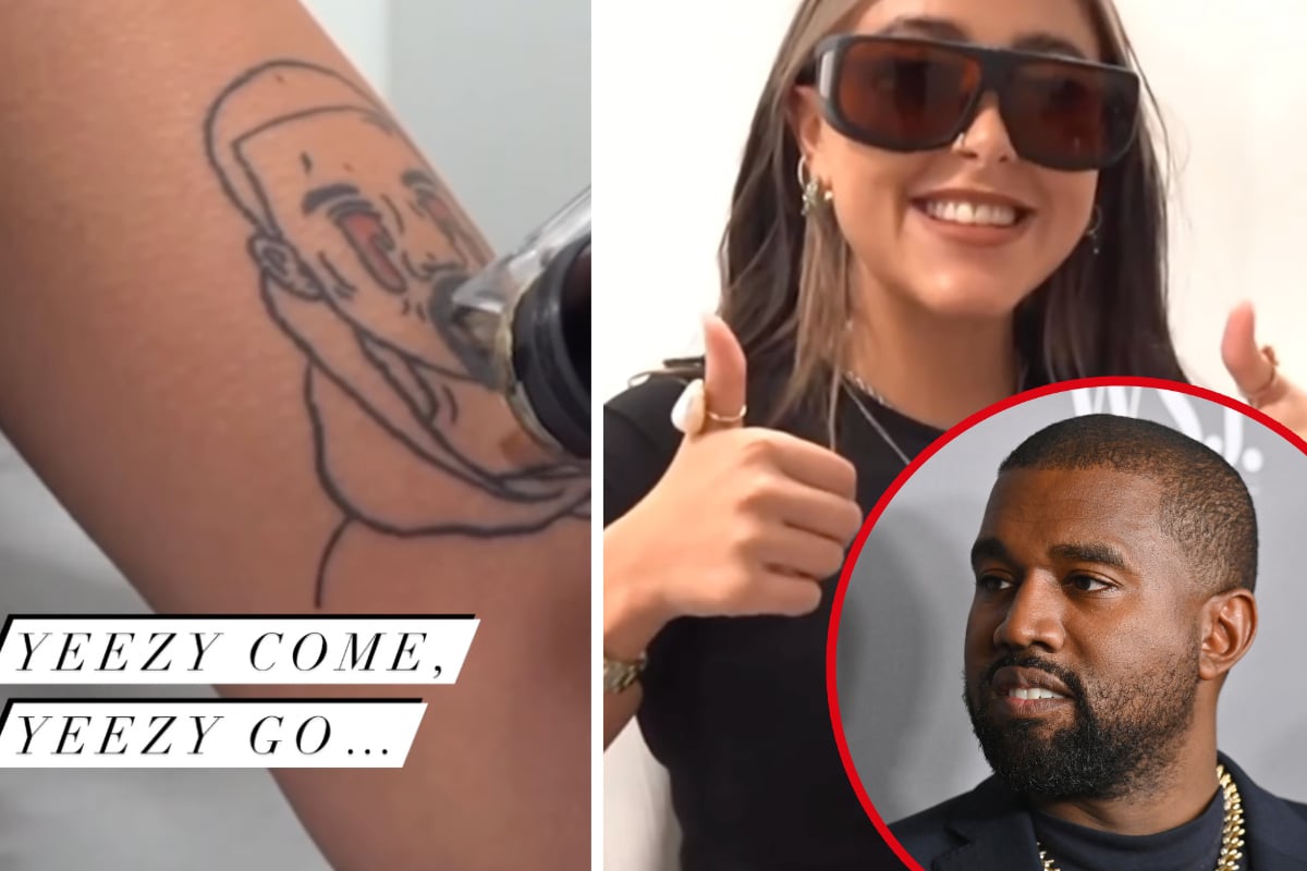 Kanye West Tattoos Being Removed for Free by a London Studio