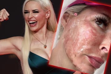 Daniela Katzenberger: Schock-Bilder auf Instagram: Was ist mit Daniela Katzenberger passiert?