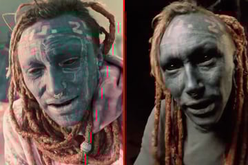 Extreme body mod artist tattoos client's grey eye white in radical procedure