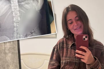 Frau isst Joghurt, als Hund auf sie springt: Was dann passiert, entsetzt so viele