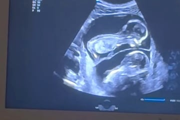 Als Schwangere dank Ultraschall sieht, was ihre Babys gerade tun, ist sie sprachlos