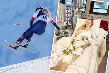 Arzt von Lindsey Vonn meldet sich nach 3. Operation: "Heikle Situation"