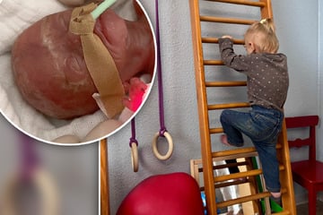 Nur 300 Gramm: Mini-Frühchen schafft den Sprung ins Leben