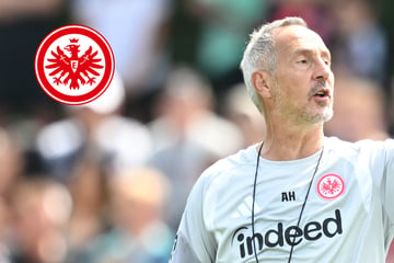 Hütter sieht Handlungsbedarf: Auf diesen Positionen will der SGE-Coach noch Verstärkungen