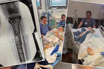 Schon fünfmal operiert: Lindsey Vonn verteidigt Olympia-Comeback und teilt gegen "Hater" aus