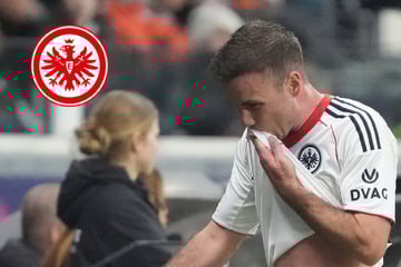 "Beschissen": Götze spricht vor Riera-Start bei Frankfurt Klartext
