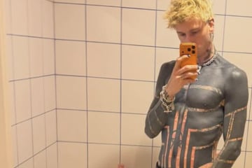 "Meine Haut wurde gelb": Rapper enthüllt, wie krank ihn sein Blackout-Tattoo macht