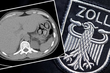 Köln: Mit Kokain im Bauch auf Reisen: Zoll schnappt Körperschmuggler