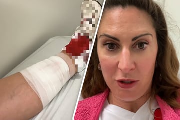 TV-Moderatorin greift bei eskalierter Hundebegegnung ein: Krankenhaus!