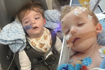 Weltweit einmalig: Zweijähriger leidet an nie zuvor gesehener Krankheit