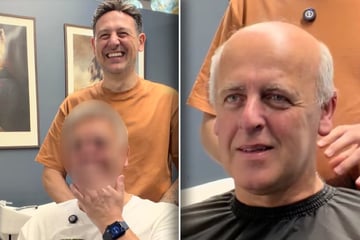 Mann lässt sich Haarsystem verpassen: Ergebnis sorgt für großes Staunen