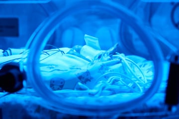 Kann KI Babys retten? Projekt für Frühchen gibt Hoffnung