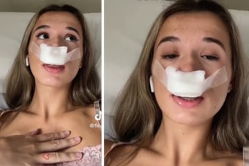 TikTokerin erzürnt nach OP das Netz: "Damit meine Kinder mit einer schönen Nase geboren werden"