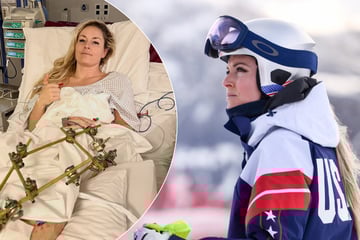 Lindsey Vonn undergoes third surgery for leg injury from Olympics crash