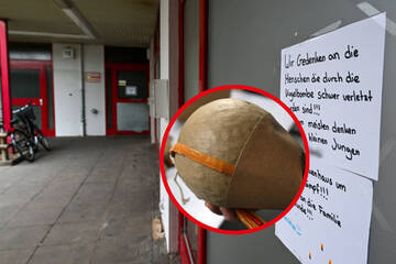 Berlin: Mehr als 40 (!) Operationen: Siebenjähriger überlebt Kugelbomben-Explosion