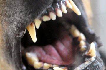 Hund beißt Spaziergänger Finger ab