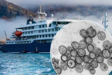 Hantavirus: Wie hoch ist die Gefahr einer Infektion in Deutschland?