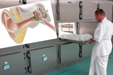 Dresden: Haben Mediziner Knochen von Toten geklaut? Dresdner Uniklinik zieht Konsequenzen