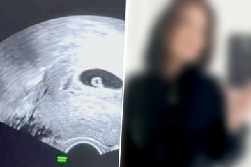 Schicksalsschlag für Reality-Star: "Beauty & The Nerd"-Bekanntheit verliert ihr Baby